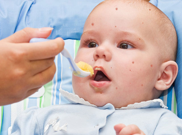 food-allergy-symptoms-babies